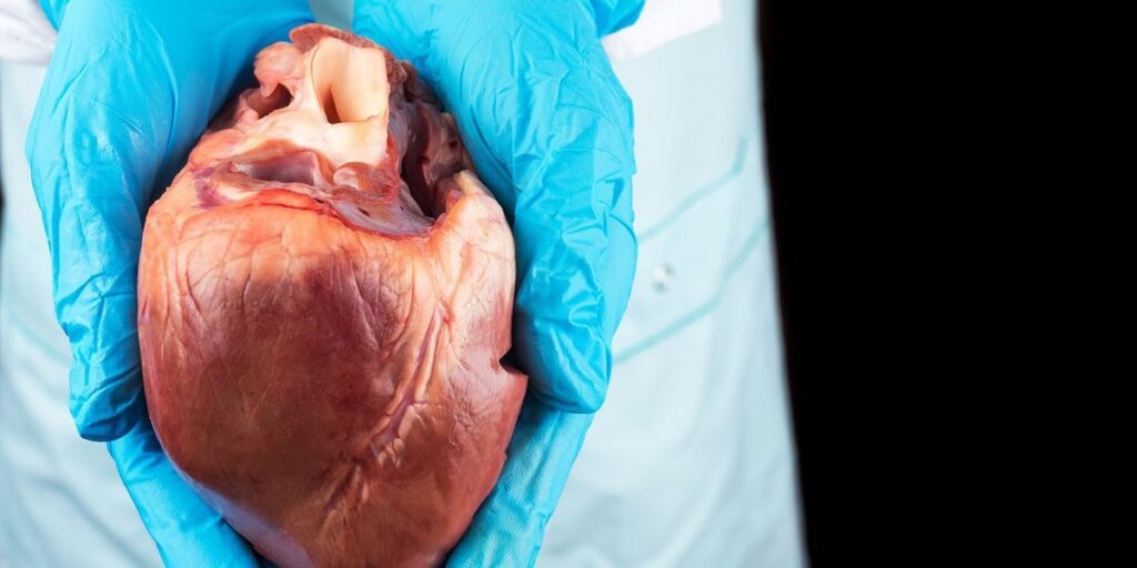 3D printers could make organs