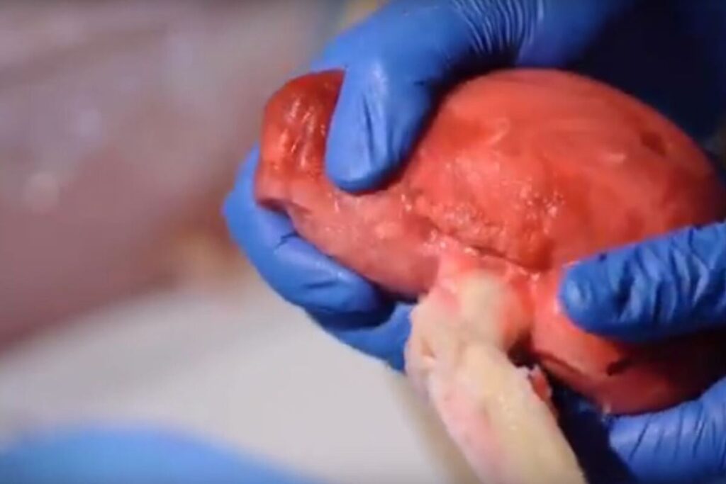 3D printers could make organs