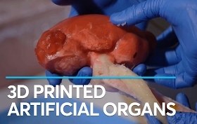 How 3D-printed organs