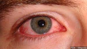 Dry eye is the symptom of covid-19