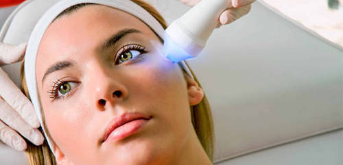 laser photo facial 