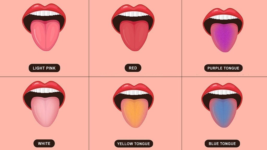 The color of the tongue will tell the secret of health