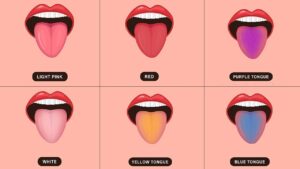 The color of the tongue will tell the secret of health