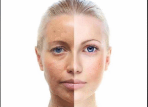 Does your skin look dull for no reason?